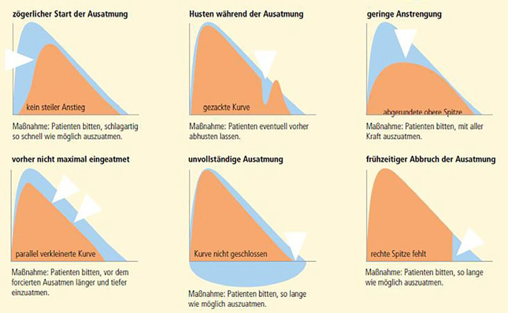 Fehler bei der Lungenfunktionsmessung